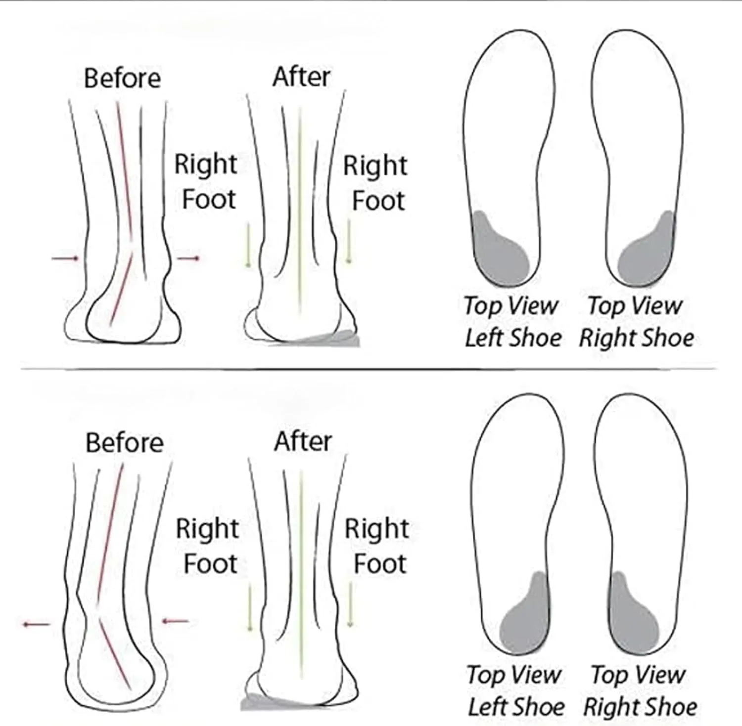 Women's Soft Sole Mesh Comfort Orthopedic Shoes, Cute Lightweight Soft Solecomfortable Flat Arch Support Walking Shoes